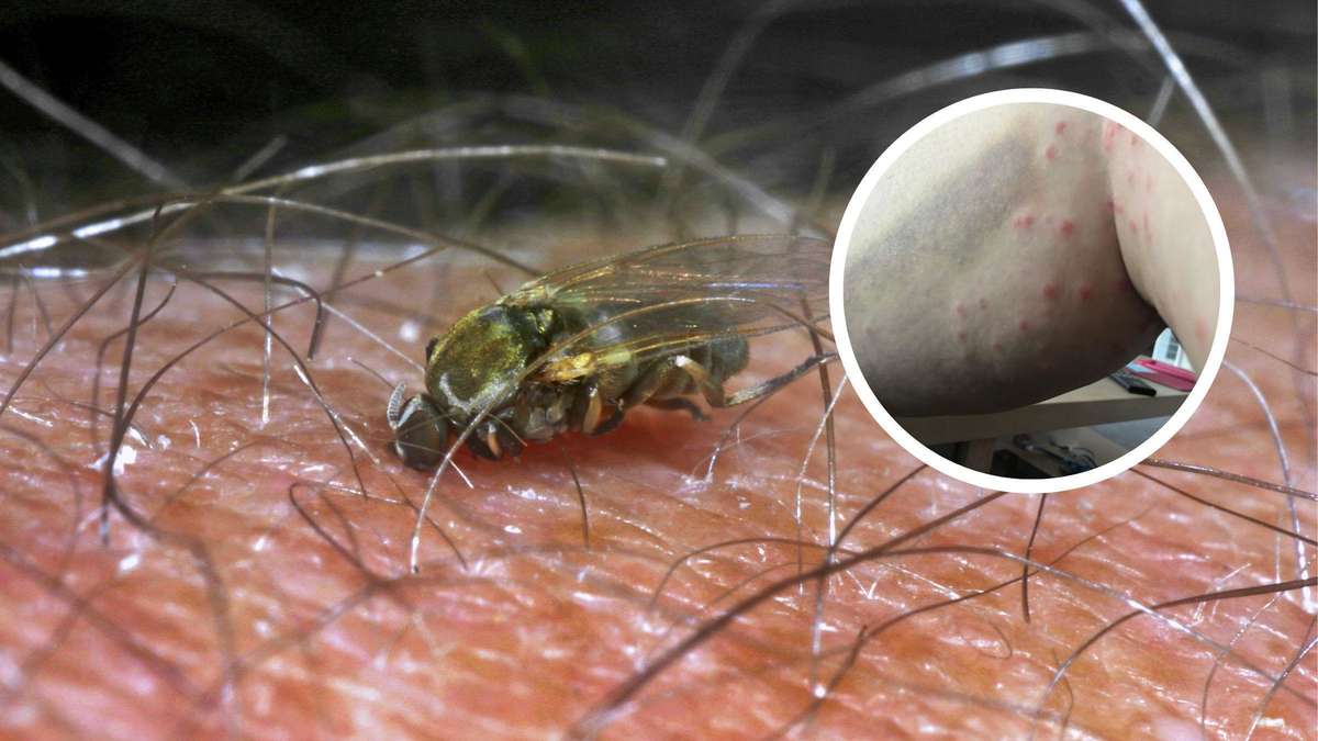 Tückische Insekten-Plage in Deutschland – „musste schon Antibiotikum nehmen“