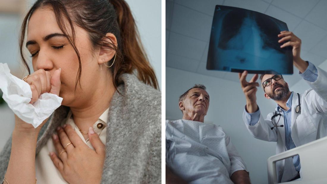 Entzündungsreaktionen bei einer Atemwegsinfektion können im menschlichen Körper verheerende Folgen haben – und laut einer neuen Studie womöglich auch mit Krebs in Zusammenhang stehen.