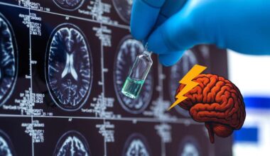 Neue Spur in der Alzheimer-Forschung: Bestimmter Nährstoff beeinflusst Demenz-Risiko