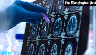Ist das der Schlüssel zur Umkehrung von Alzheimer? - Frankfurter Rundschau
