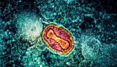 Neue Mpox-Variante breitet sich schnell aus