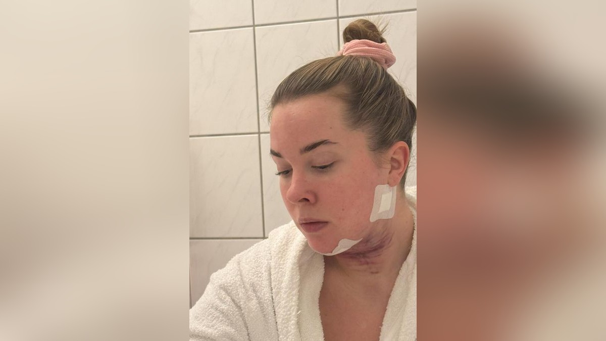 Jessy Pohler Dortmund Doppelkinn-OP