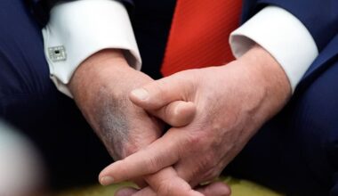 Trumps rechte Hand sorgt für Spekulationen