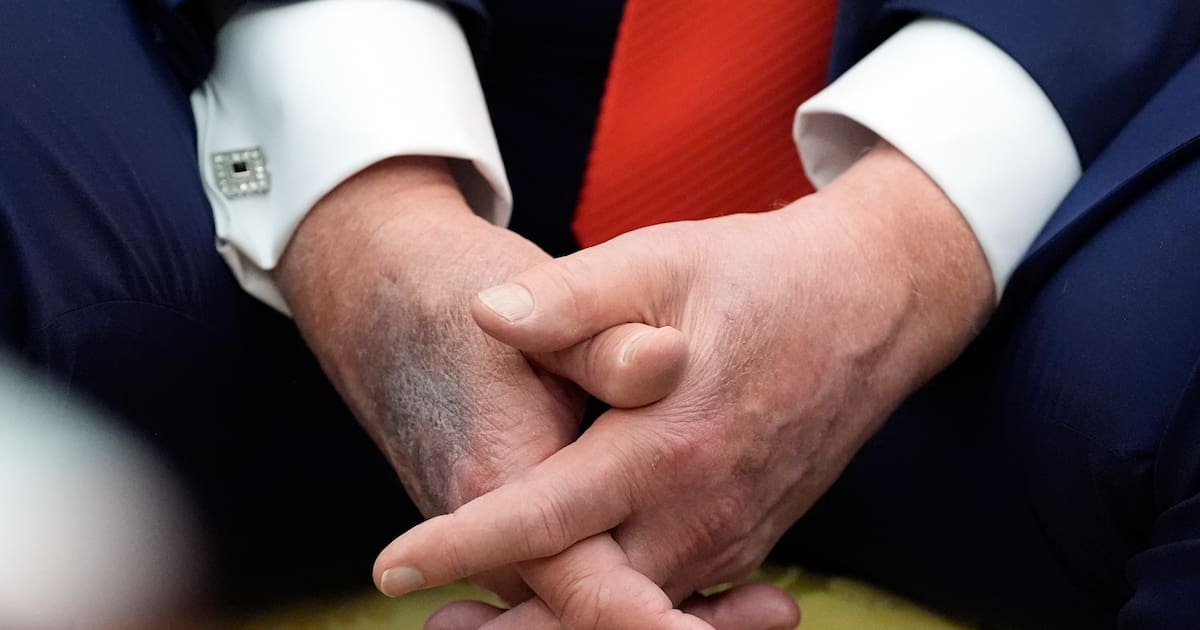 Trumps rechte Hand sorgt für Spekulationen