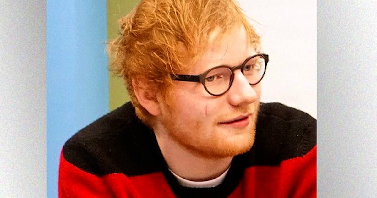 Fünf Fakten zum Superstar: Woher Ed Sheeran seine Narbe hat und wem er einen Phallus schenkte