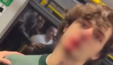 Verletzungen im Gesicht: US-Amerikaner teilt Video nach Messerangriff in Dresden