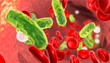Neue Leitlinie: Mit drei Kriterien zur Sepsis-Diagnose? - Ärzte Zeitung