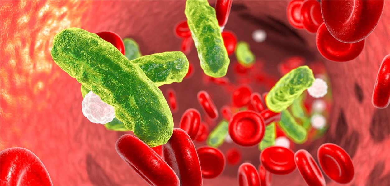 Neue Leitlinie: Mit drei Kriterien zur Sepsis-Diagnose? - Ärzte Zeitung
