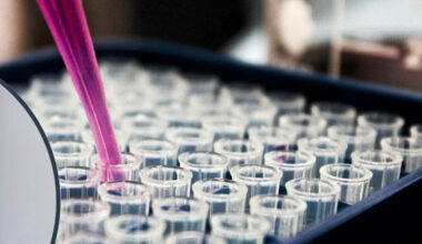 ATOS Wiesbaden: Stammzellentherapie gegen Arthrose