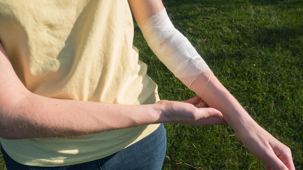 Vereinigtes Königreich - Seltene Hautkrankheit: Neuer Therapie-Ansatz gibt 12-jährigem Jungen Hoffnung