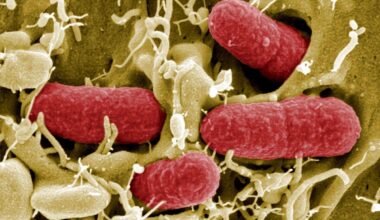 Berlin | Häufung von Ehec-Infektionen - wie gefährlich ist das?