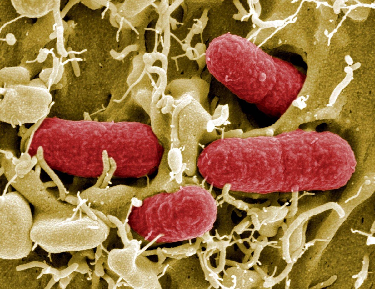 Berlin | Häufung von Ehec-Infektionen - wie gefährlich ist das?