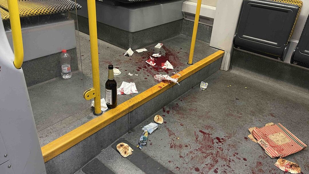 Blutige Attacke in Linie 7 - Opfer erhebt schwere Vorwürfe