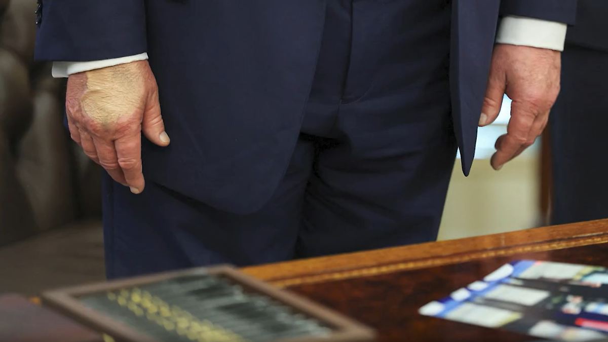 Der Tag: Make-up-Flecken auf Trumps Hand werfen Fragen auf
