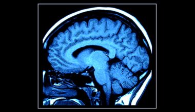 Mit einem einzige MRT-Scan das biologische Alter ermitteln