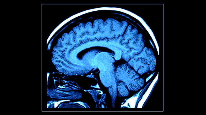 Mit einem einzige MRT-Scan das biologische Alter ermitteln