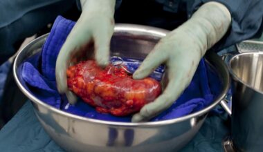 Neues Genmatching könnte Erfolgsrate bei Nierentransplantation verbessern – News – Deutsches Ärzteblatt