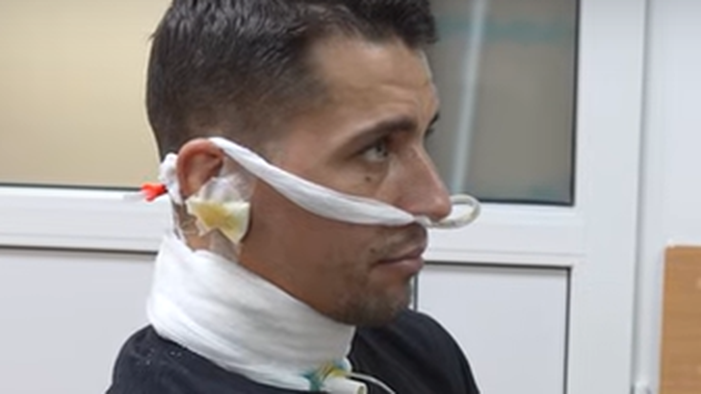 Ukrainischer Soldat rettet sich mit durchgeschnittener Kehle ins Krankenhaus