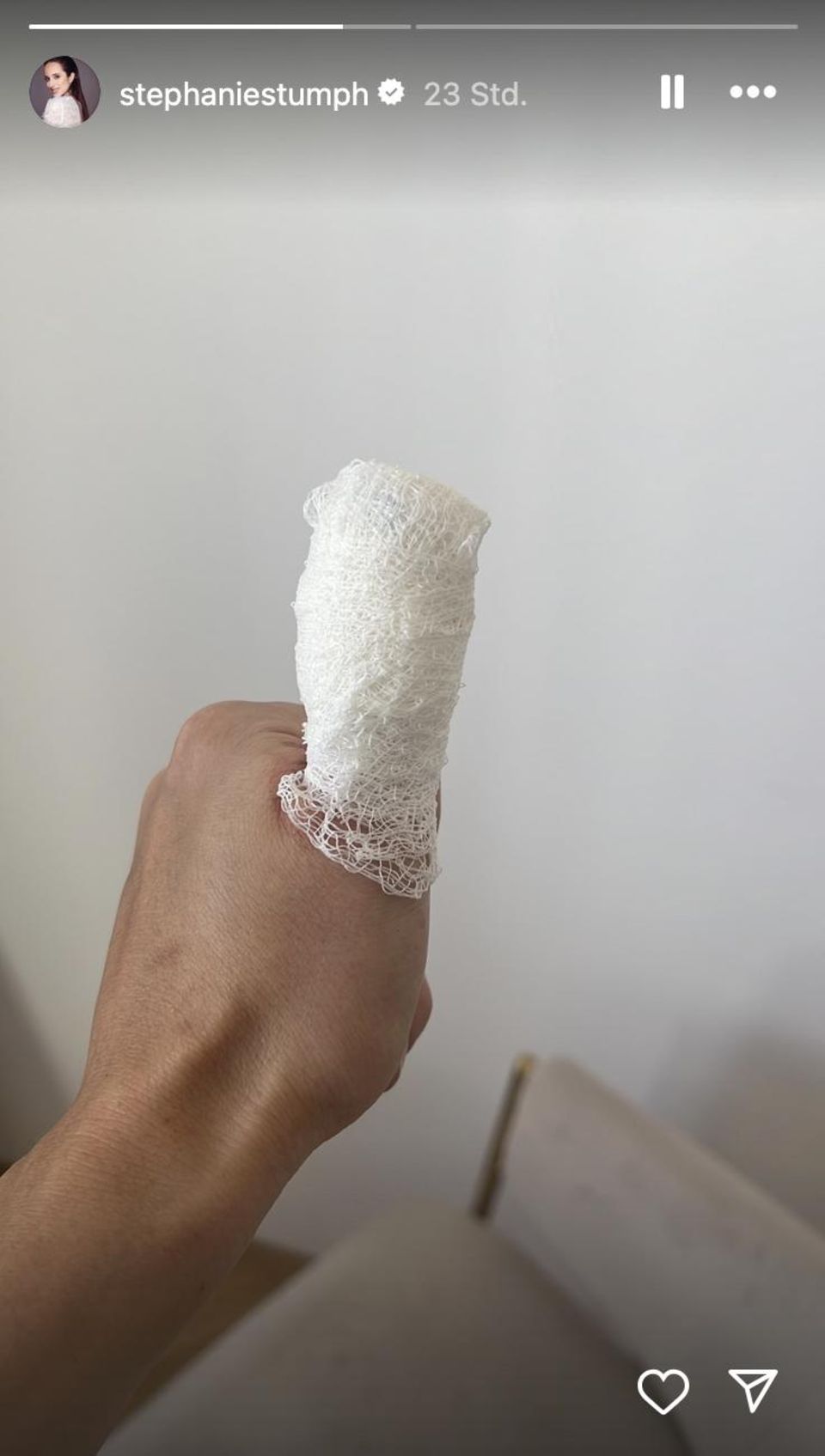 Stephanie Stumph: Nach Mini-OP in der Nestbau-Phase angekommen
