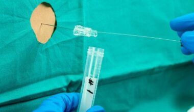 Metaanalyse bestätigt: pTau217 ist der beste Alzheimer-Serum-Marker