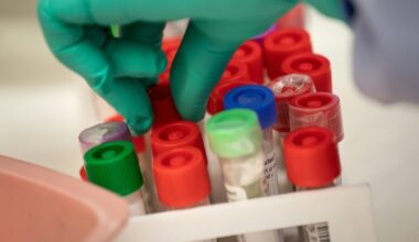 WHO hebt höchste Alarmstufe für Infektionskrankheit Mpox auf - News Augsburg, Allgäu und Ulm
