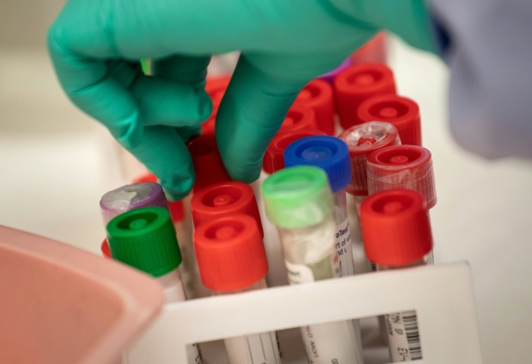 WHO hebt höchste Alarmstufe für Infektionskrankheit Mpox auf - News Augsburg, Allgäu und Ulm