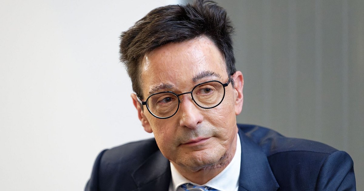 Säure-Anschlag: «Sehr interessante Spur» | NRW