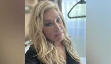 Carmen Geiss kämpft: Gehirn-OP nach Sturz | Unterhaltung