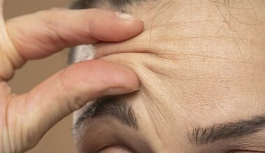 Anti-Aging-Mittel: Welche Lebensmittel Falten vorbeugen 