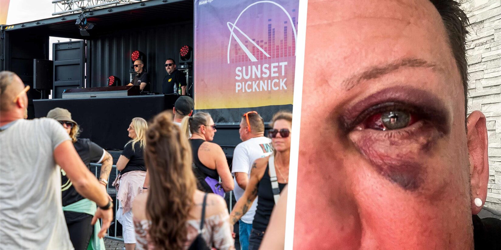 Unbekannter schlägt „mit voller Wucht“ zu