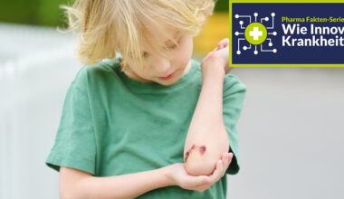 Bei der Behandlung der Bluterkrankheit hat die pharmazeutische Forschung einen Innovationsschub hingelegt. Selbst Gentherapien sind heute verfügbar. Foto: iStock.com / SbytovaMN