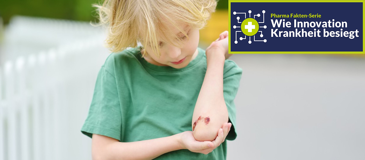 Bei der Behandlung der Bluterkrankheit hat die pharmazeutische Forschung einen Innovationsschub hingelegt. Selbst Gentherapien sind heute verfügbar. Foto: iStock.com / SbytovaMN