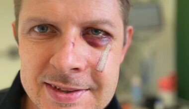Dresden: Neonazi verprügelt SPD-Politiker und nichts passiert | Regional