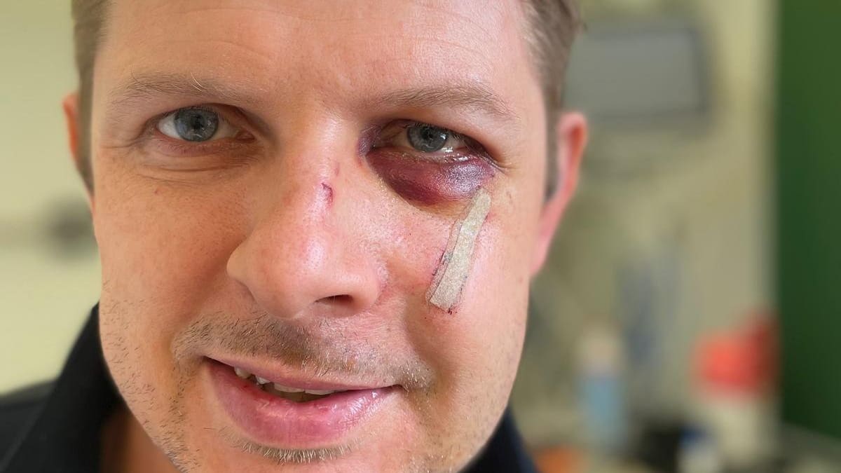 Dresden: Neonazi verprügelt SPD-Politiker und nichts passiert | Regional