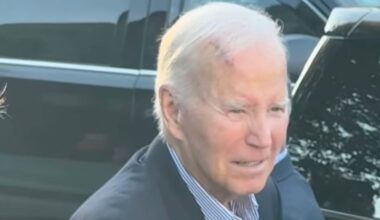 Ex-Präsident Joe Biden mit riesiger Narbe auf dem Kopf | Politik