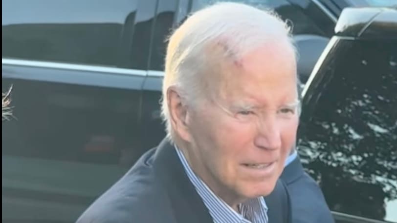 Ex-Präsident Joe Biden mit riesiger Narbe auf dem Kopf | Politik