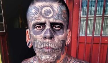 Krasse Transformation: Mann lässt sich alle Tattoos im Gesicht entfernen | News