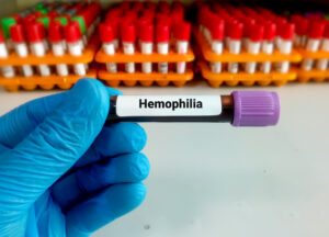 Hämophilie