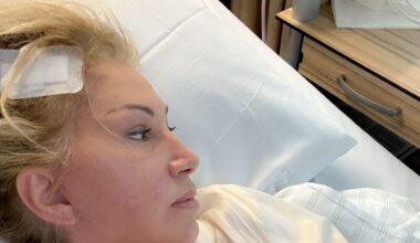 Carmen Geiss übersteht Gehirn-OP erfolgreich | Unterhaltung