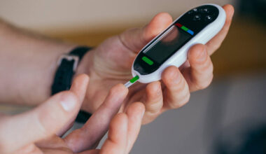 Prädiabetes lässt sich häufig zurückdrehen