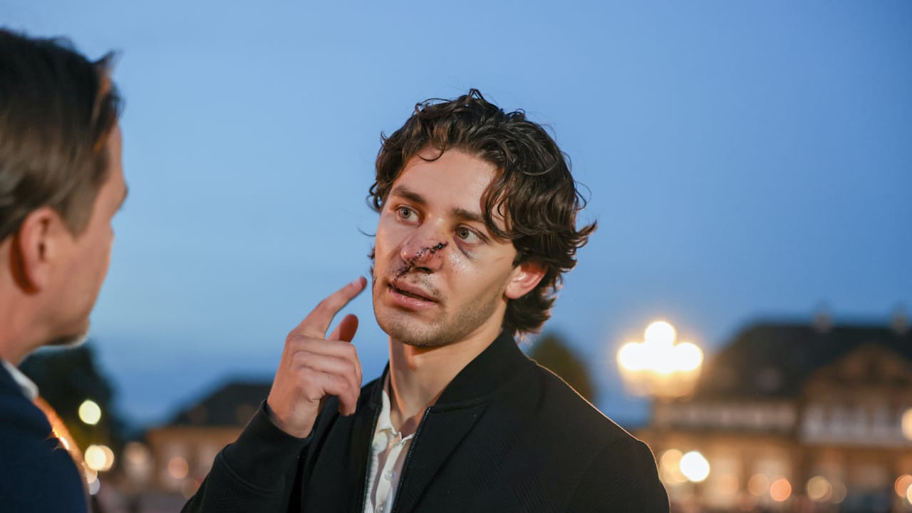 Messer-Angriff in Dresden: US-Tourist John Rudat verlor fast ein Auge. | Regional