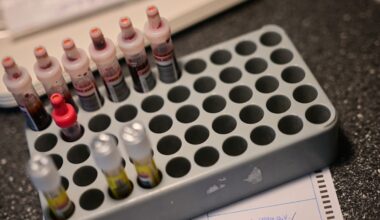 Zahl von Syphilisfällen in Deutschland erneut gestiegen – Hamburg und Berlin besonders betroffen