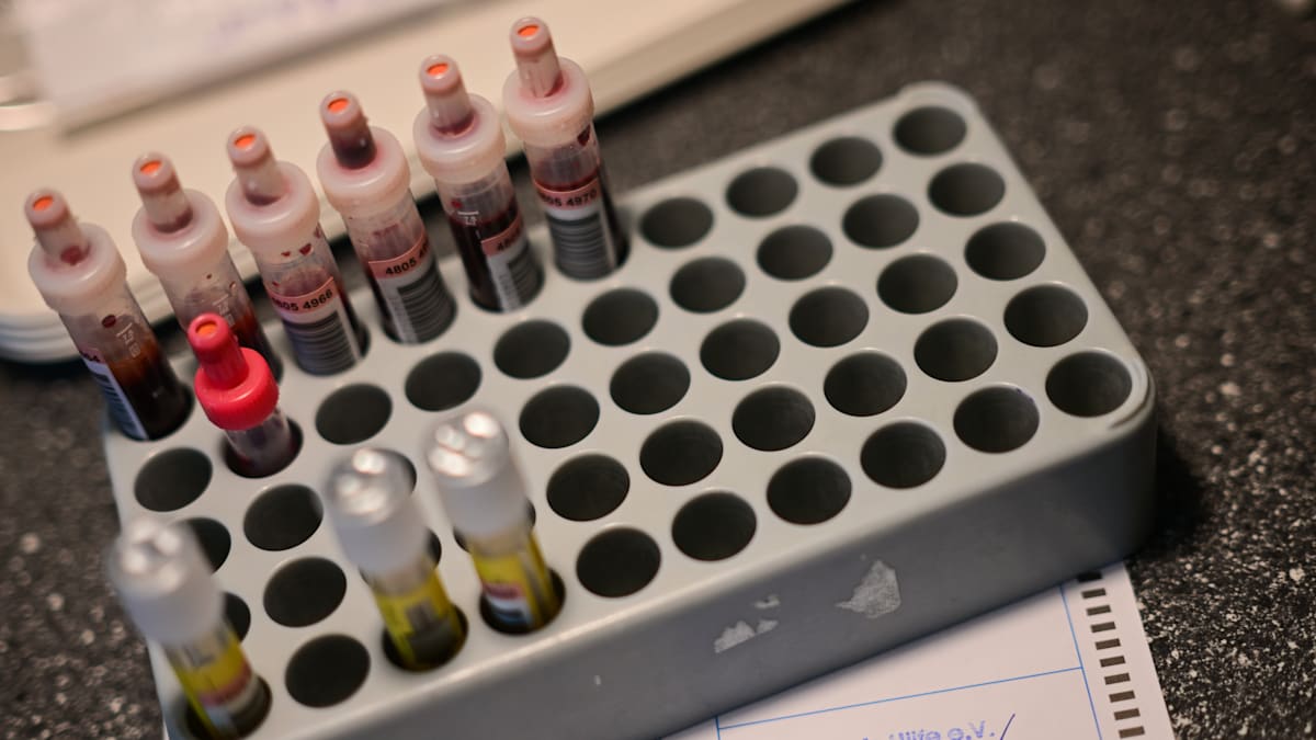 Zahl von Syphilisfällen in Deutschland erneut gestiegen – Hamburg und Berlin besonders betroffen