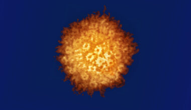 Herpes simplex