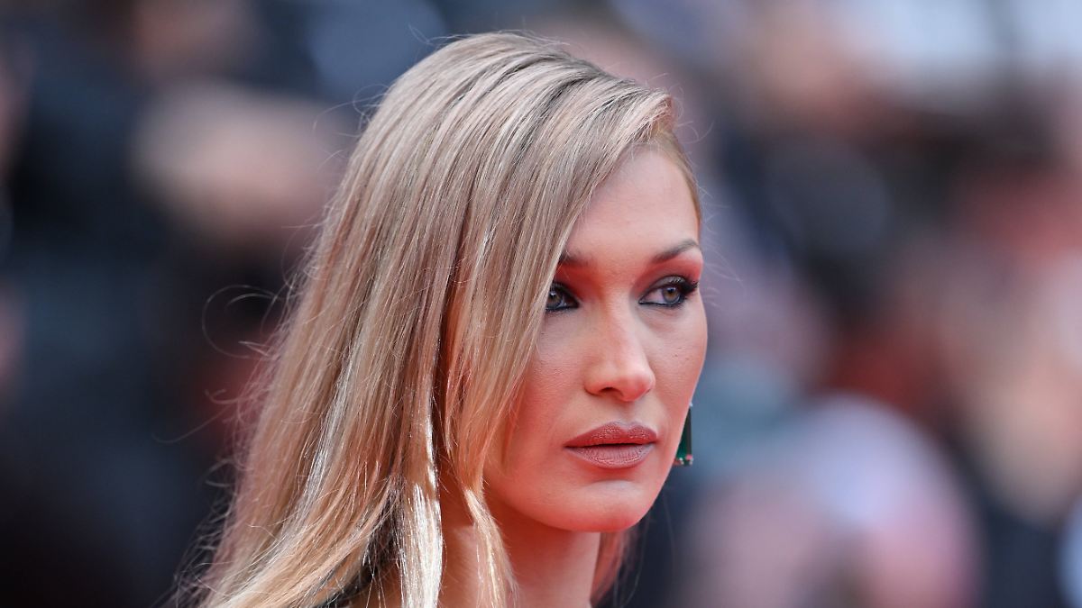 Ihr Abtauchen tut ihr leid: Bella Hadid schockt mit drastischen Krankenhaus-Bildern