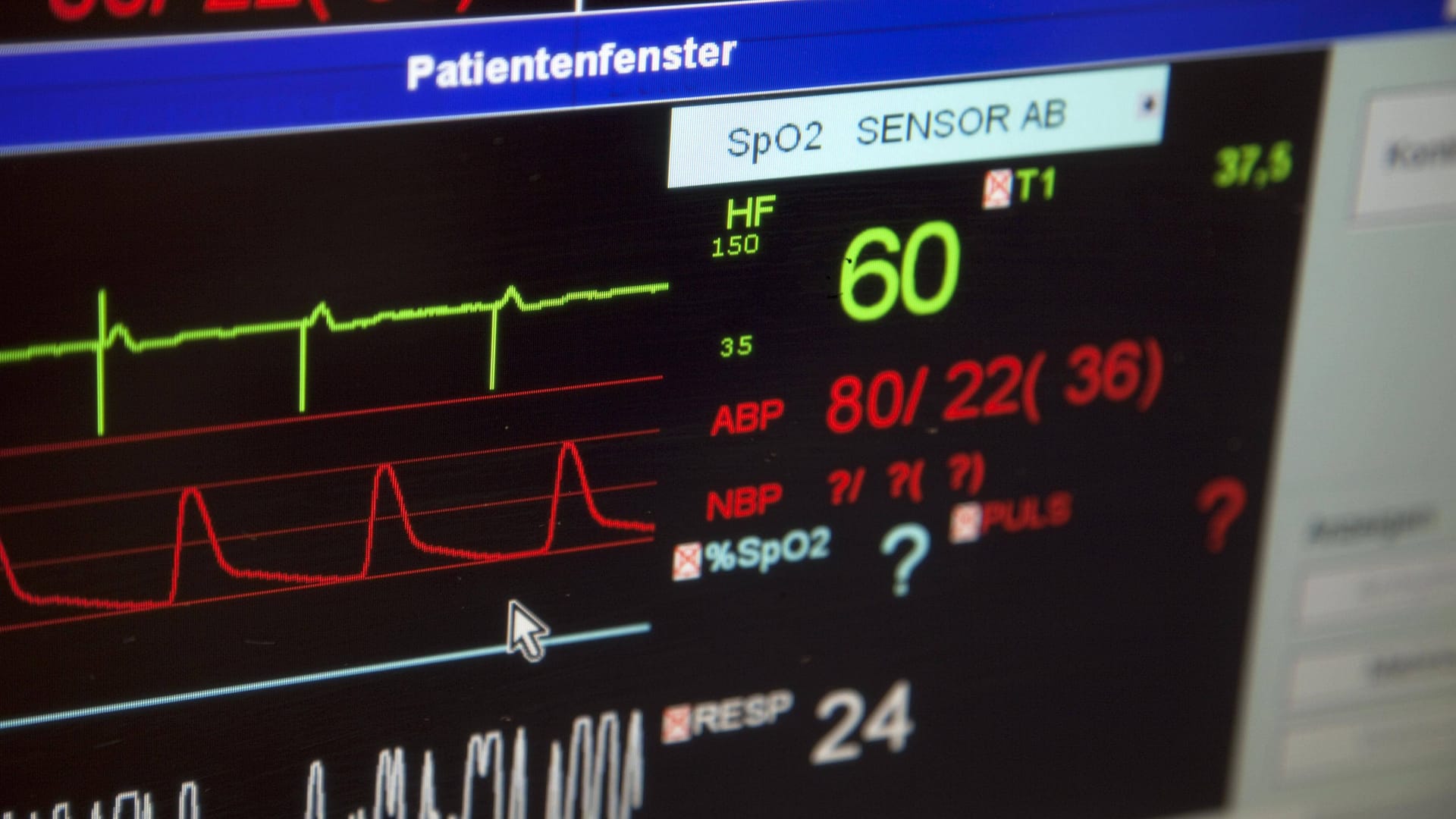 Kontrollmonitor einer Intensivstation: Mit einem solchen Gerät wird im Krankenhaus ständig die Herzfunktion überprüft.