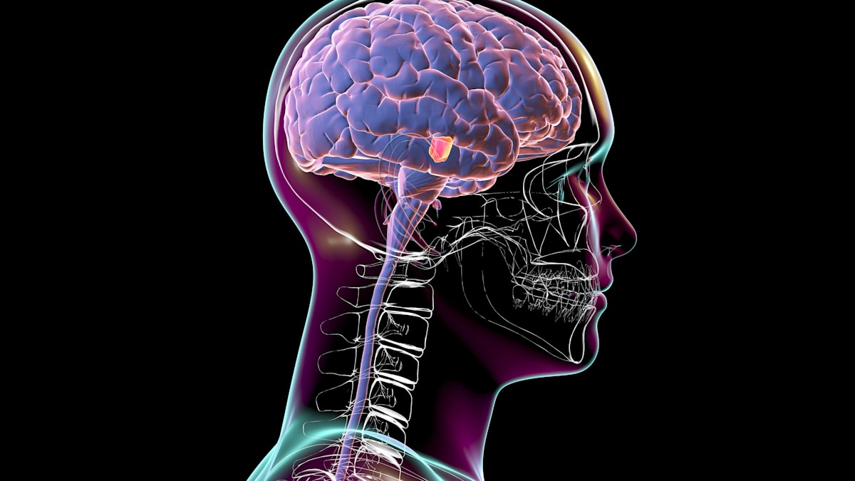 Parkinson: „Bemerkenswerte Genauigkeit“ – Wie ein Helm ohne Operation die Erkrankung lindern könnte