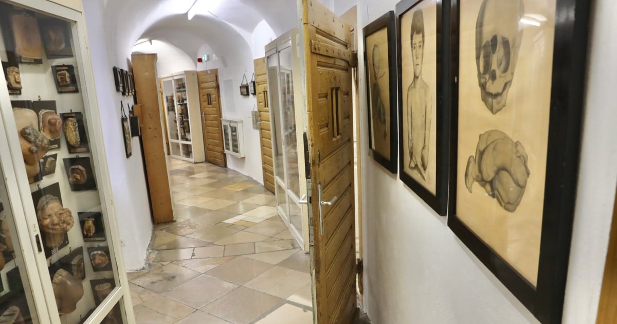 Neue Ausstellung - Narrenturm zeigt Kunstwerke menschlichen Siechtums