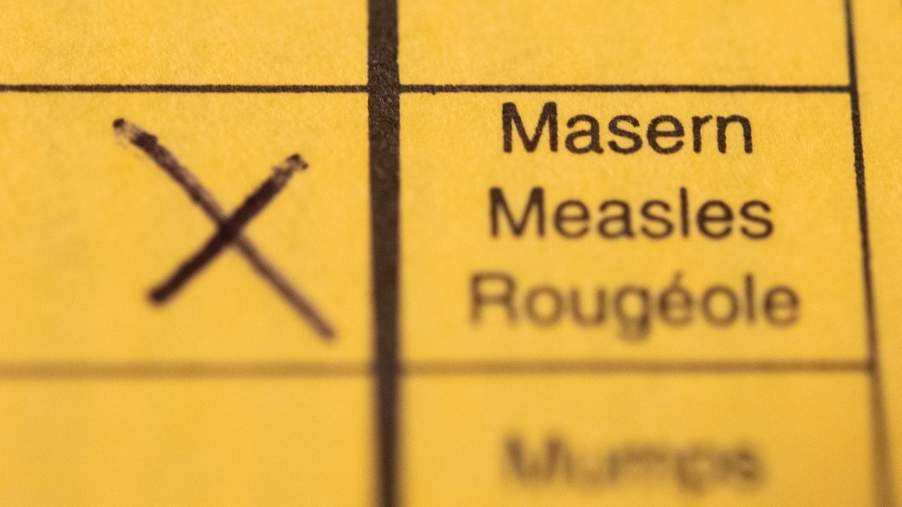 Baden-Württemberg: Masern ausgebrochen - Christliches Zentrum Karlsruhe bekommt Auflagen