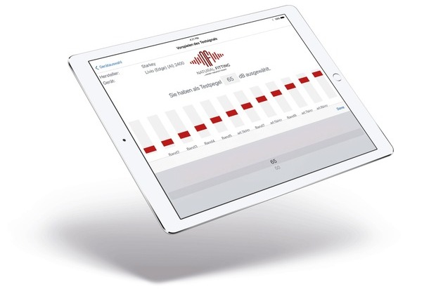 „Natural Fitting ermöglicht uns, das Beste aus der Technik herauszuholen.“ ...